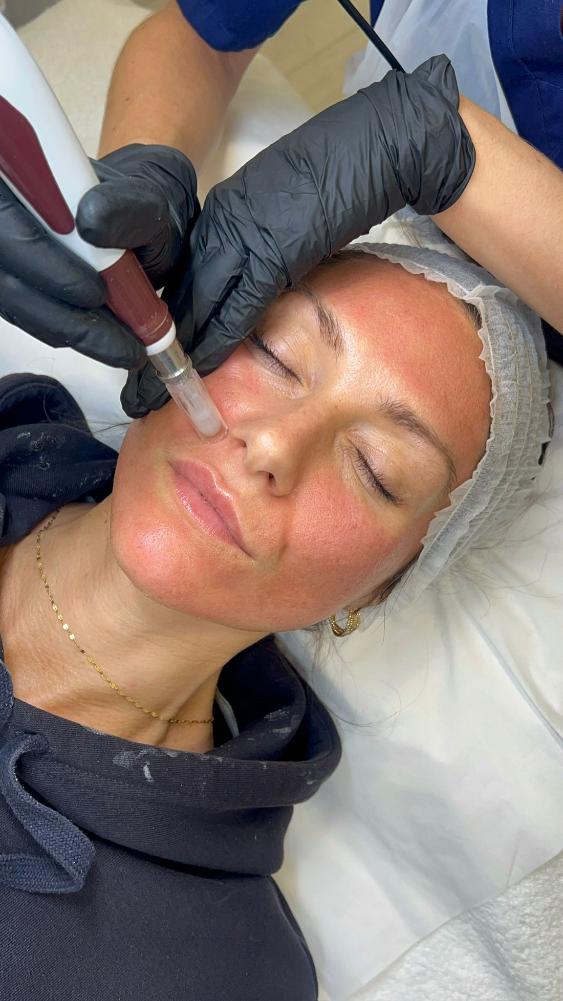 A gentle peel combined with LED therapy to boost skin renewal, hydration, and radiance.